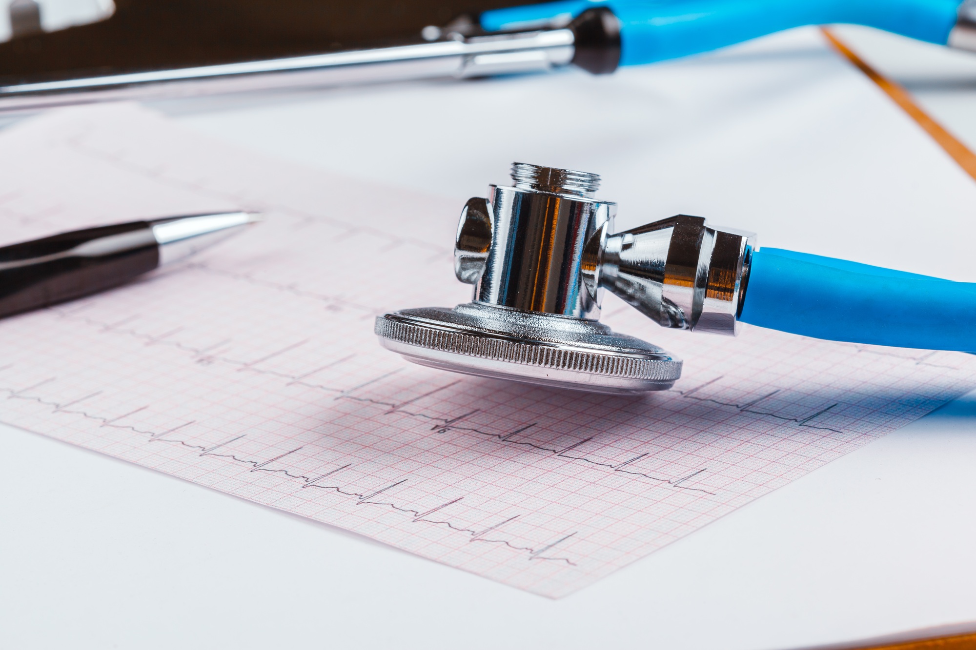Stethoscope on cardiogram sheet. Macro photo. Close up
